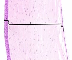 Image: corneal endothelium