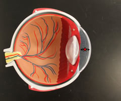 Image: anterior chamber