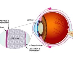 Image: Descemet