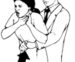 Image: abdominal thrusts