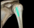 Image: Bicipital groove