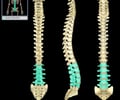 Image: Lumbar Vertebrae