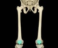 Image: patella