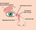 Image: nasolacrimal duct