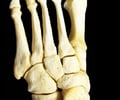 Image: Distal phalanges of the foot