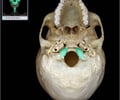 Image: Occipital condyles