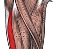 Image: Vastus Lateralis