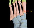 Image: Proximal phalanges of the foot