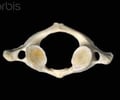 Image: Atlas vertebrae