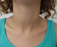 Image: neck