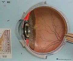 Image: ciliary body
