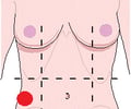 Image: right lumbar region