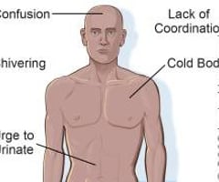 Image: symptoms of hypothermia