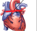 Image: heart