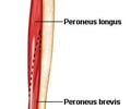 Image: Peroneus Longus