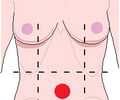 Image: umbilical region