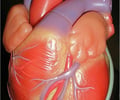 Image: artery