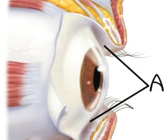 Image: bulbar conjunctiva