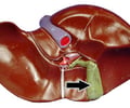 Image: gallbladder