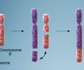 Image: reciprocal translocation