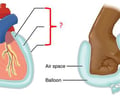 Image: serous membranes