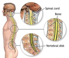Image: neck or spinal injuries