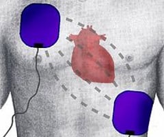 Image: defibrillation