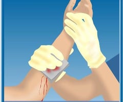 Image: caring for minor wounds