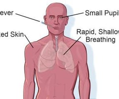 Image: symptoms of heat stroke