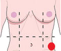 Image: left lumbar region
