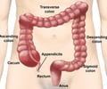 Image: large intestine