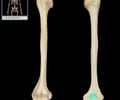 Image: olecranon fossa