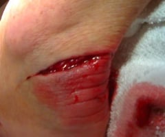 Image: lacerations