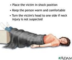 Image: treating shock
